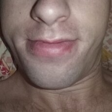 Альбик